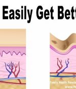 How To Easily Get Better Skin