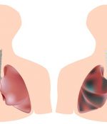 All Smokers and Ex-Smokers: 6 Foods That Will Flush Out Nicotine From Your Bodies