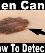 200 Forms of Cancer You Should Watch For