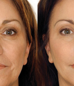 This Quick Flip Will Have You Waking Up Wrinkle Free