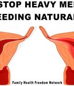 Use These 10 Natural Remedies To Combat Heavy Menstrual Bleeding